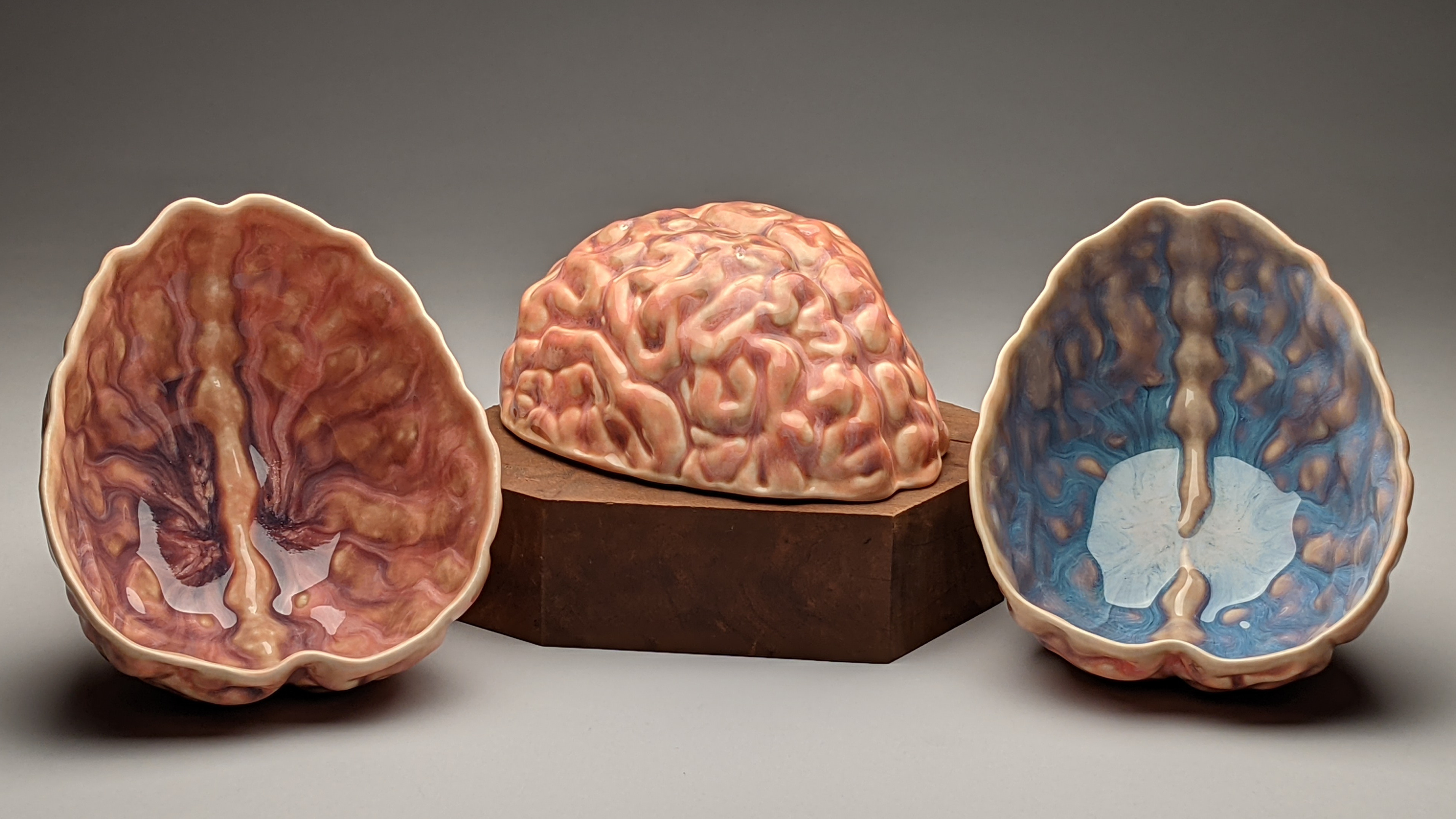 Out of Her Head: Bridget Fox’s Cabinet of Brains and Other Curiosities