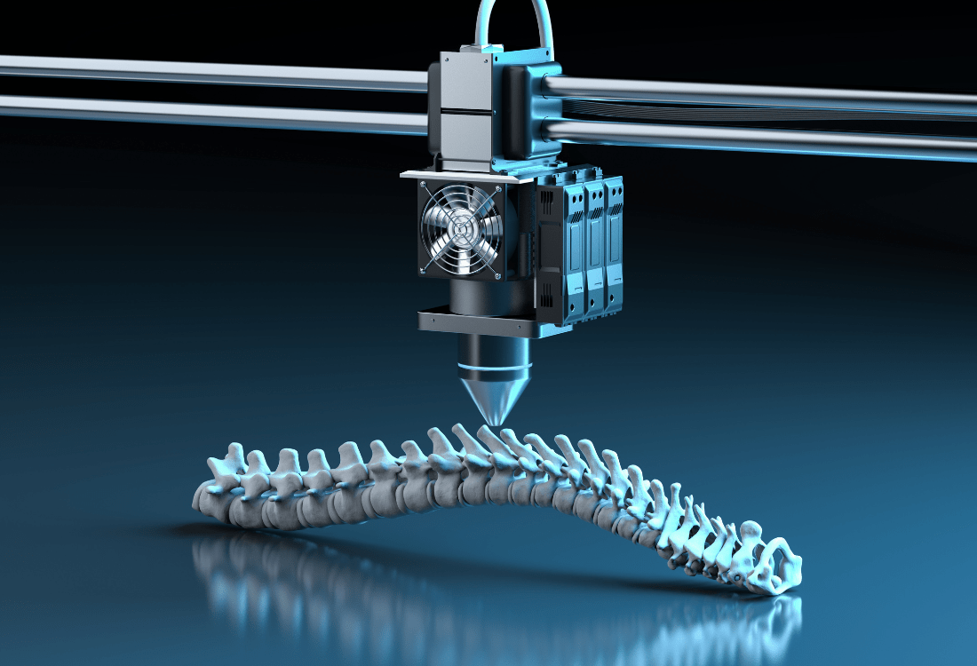 Additive manufacturing is used in the medical field to create a prosthesis for a spine.