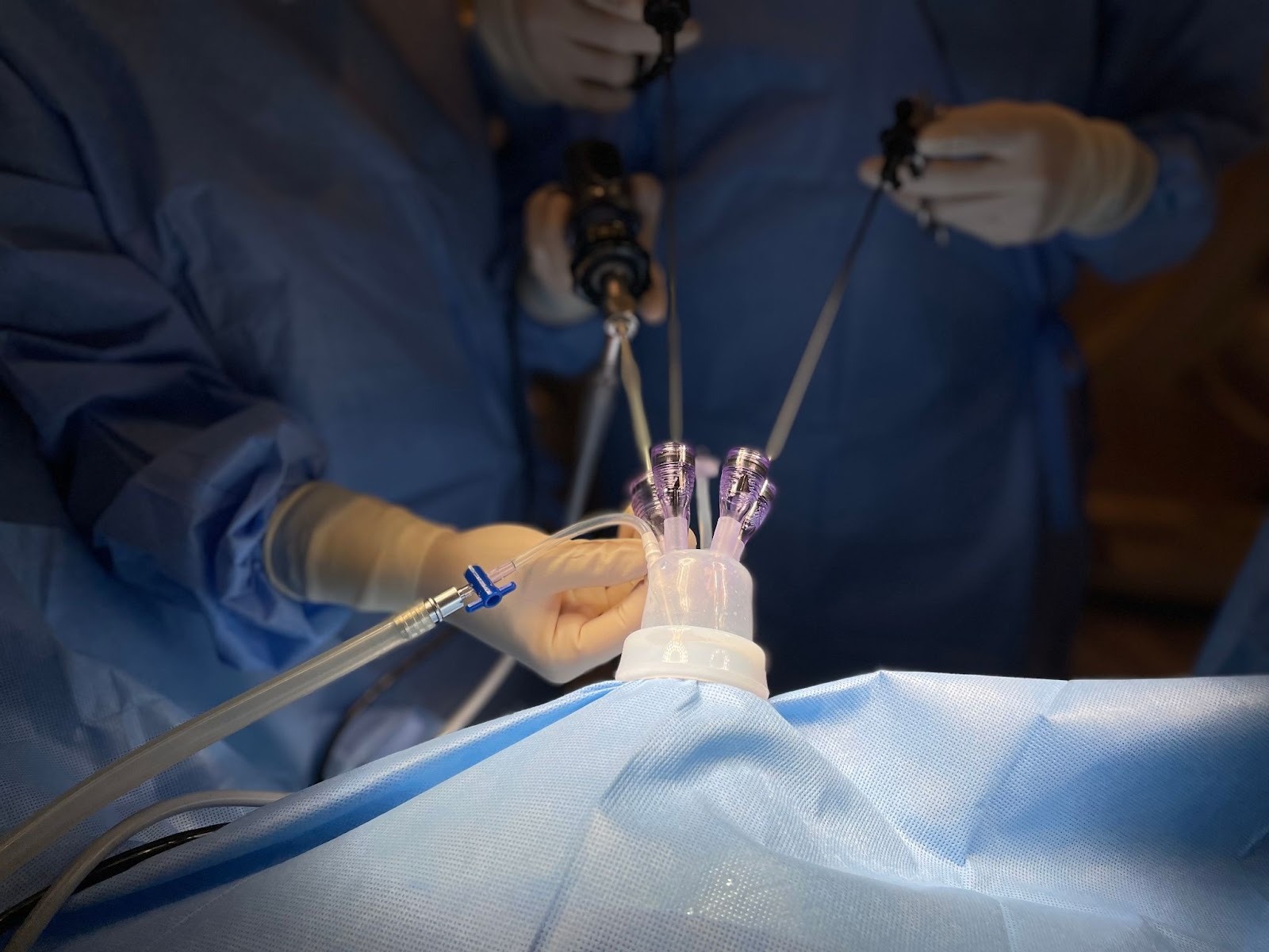 Surgeons performing a laparoscopic procedure.