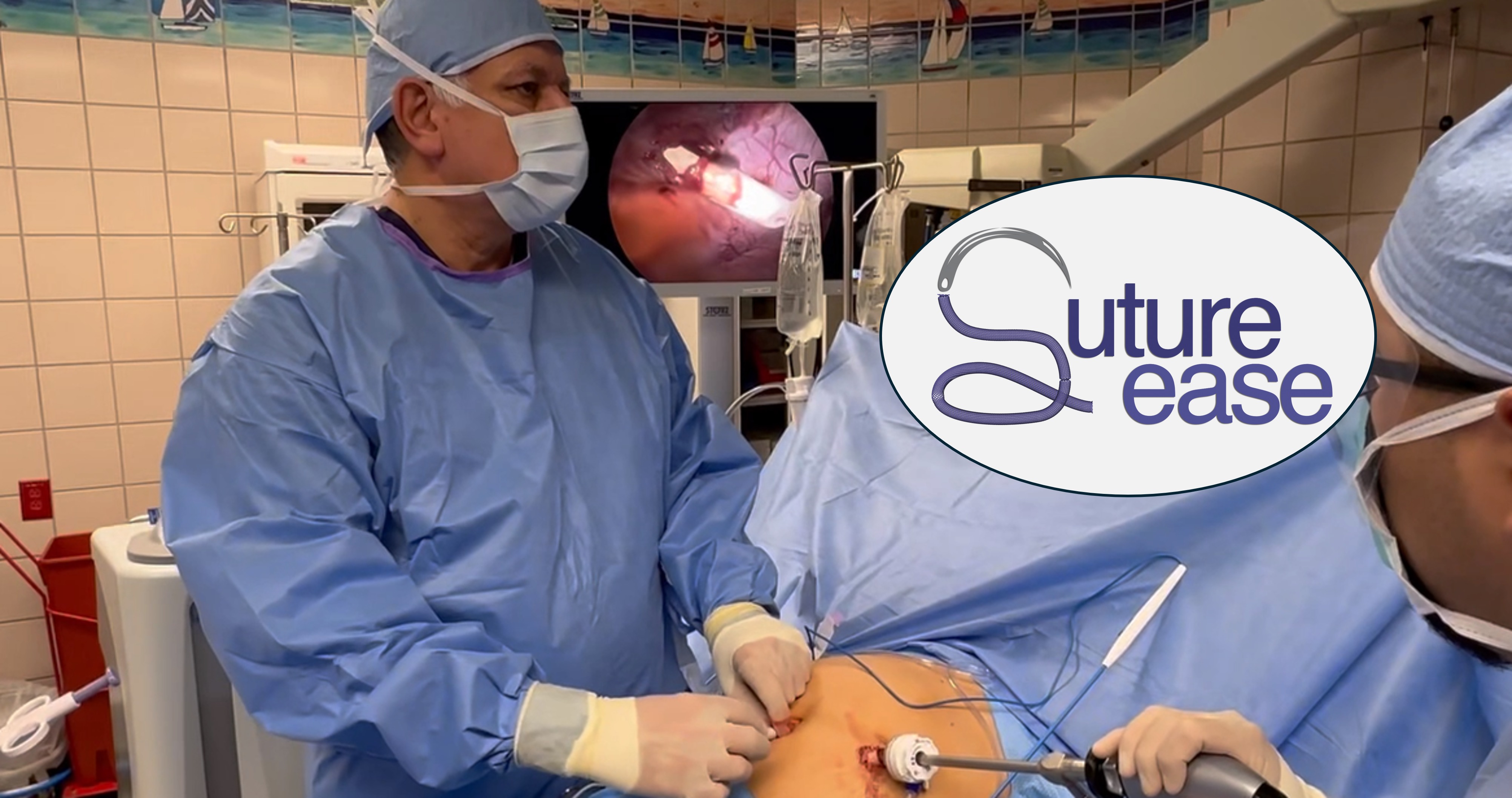 Suture Ease device used during laparoscopic port closure