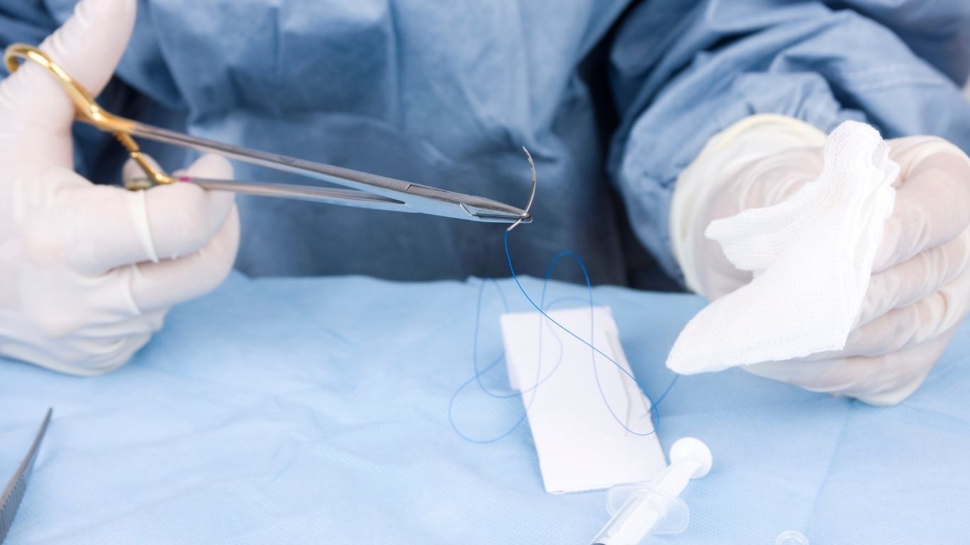 A doctor using a cumbersome needle and thread 