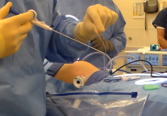 a surgeon using a suture device