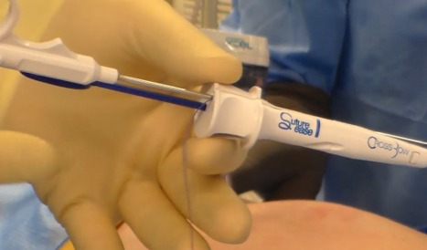 laparoscopic knot pusher system