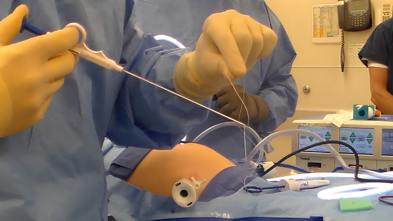 A surgeon tying sutures on a patient