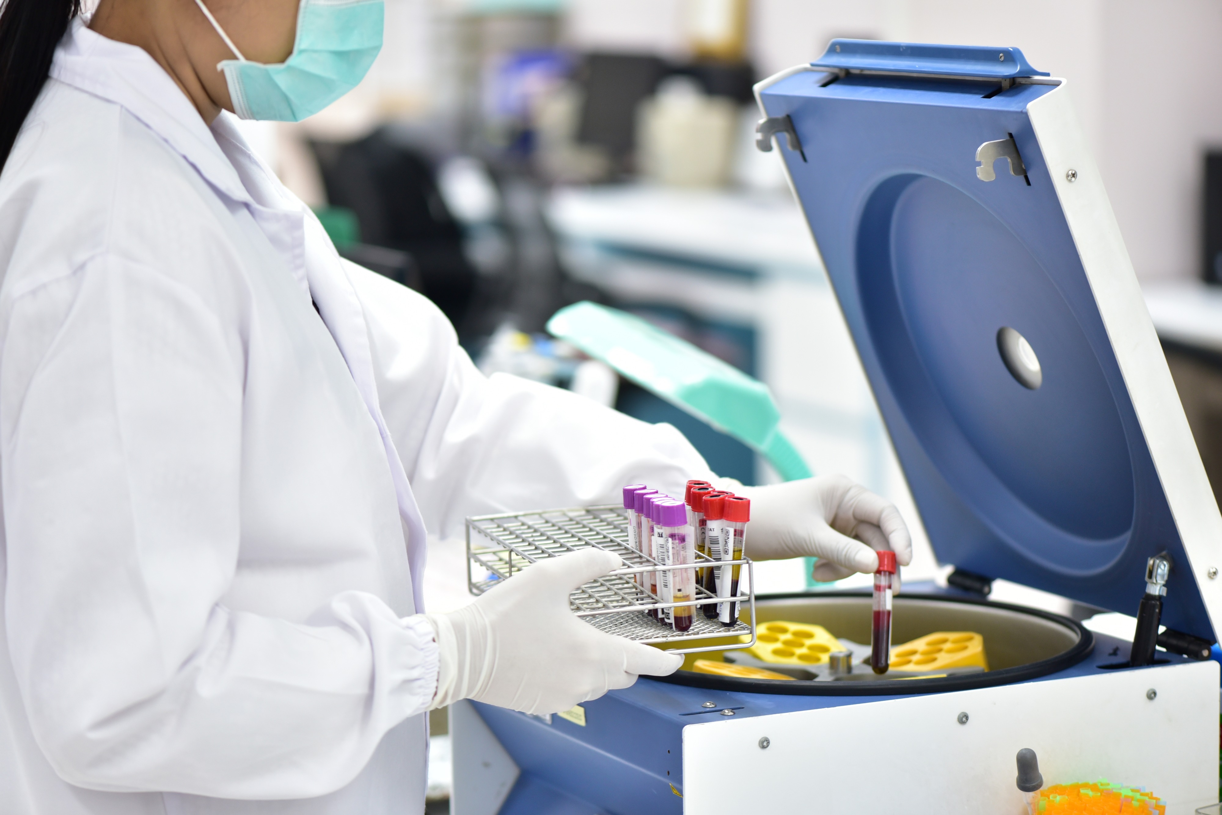 Blood samples prepared for coagulation analysis during preclinical thrombosis research